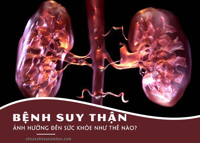 suy thận có chữa khỏi được không