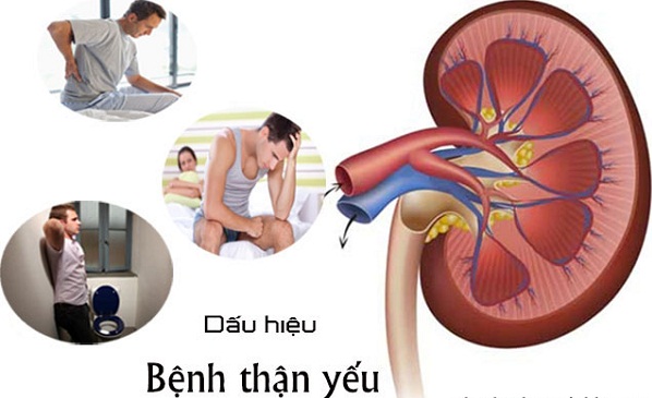 Biểu hiện thận yếu