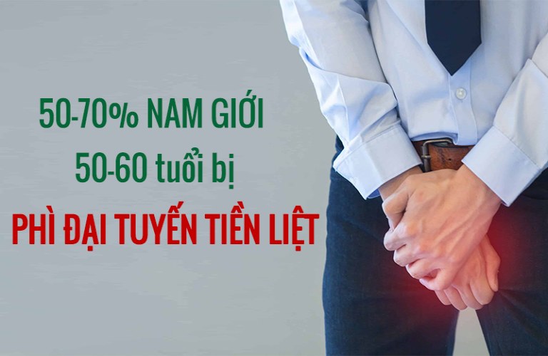 Phì đại tuyến tiền liệt là bệnh lý phổ biến ở nam giới